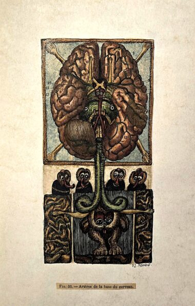 MANERO Gilles, Série anatomique, " Artères à la base du cerveau" P4