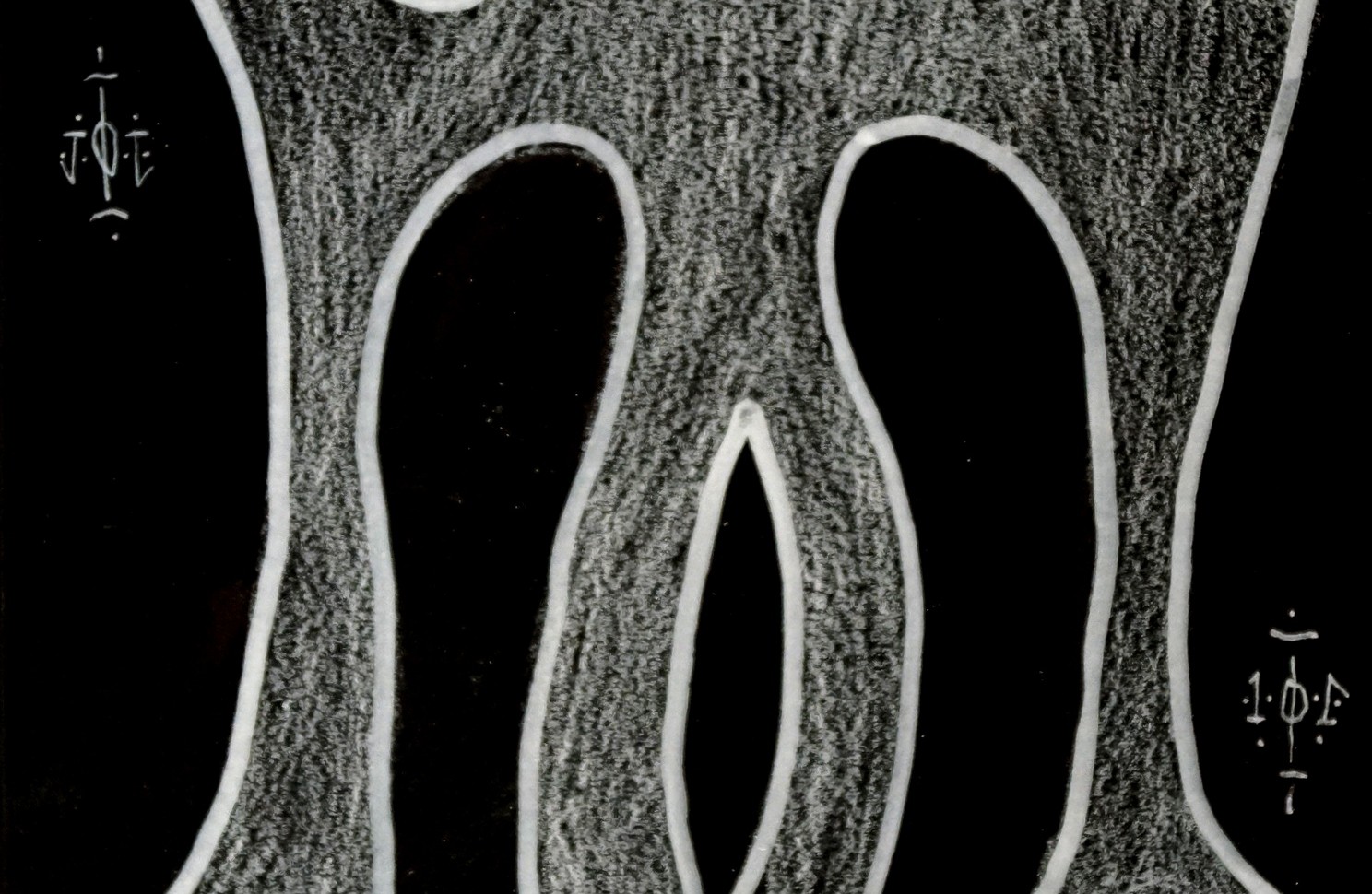 CICOLANI Davide, Série blanche 21 – Image 3